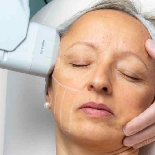 About us Wokingham 	 - Safe Treatments. No Downtime. Real Results.