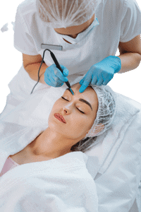 Cryopen Blemish Removal Wokingham 	