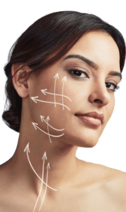 HIFU Lipo 360 Wokingham 	