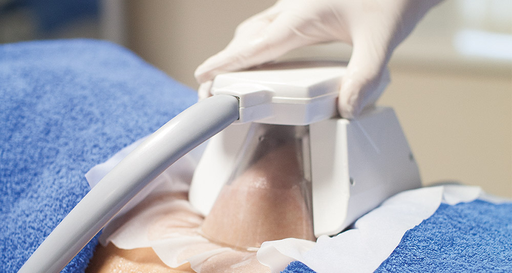 How Fat Freezing and HIFU Work Together? 2 Multiple Areas in One Session HIFU and Fat Freezing Wokingham