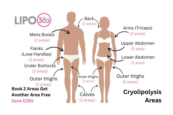 Cryolipolysis fat freezing prices from Lipo 360 Wokingham 	