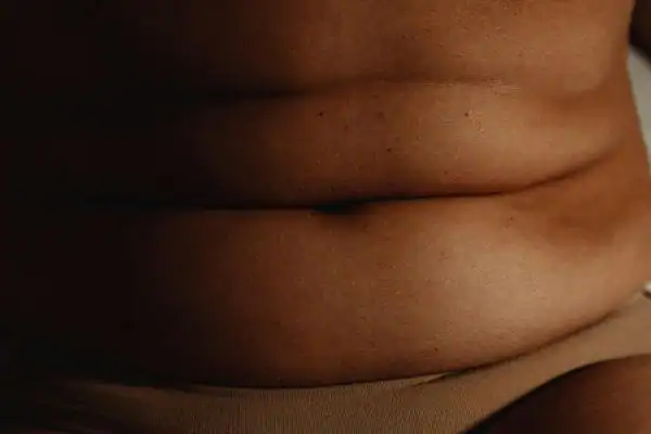 The Hidden Connection: How Stress Shapes Your Fitness and Body Composition 3 image of what stress can do on the stomach area and how Lipo 360 Wokingham can help to change your body shape.